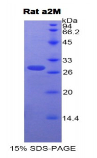 Rat Recombinant Alpha-2-Macroglobulin (a2M)